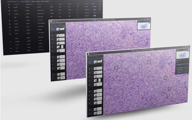 Bệnh nhân ung thư sẽ được chẩn đoán sớm với mô hình AI thị giác Bệnh nhân ung thư sẽ được chẩn đoán sớm với mô hình AI thị giác