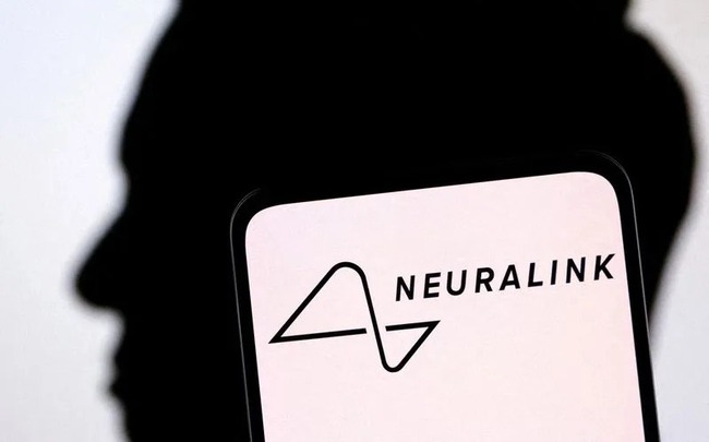 Người đầu tiên cấy chip Neuralink vào não có thể chơi game trên laptop bằng ý nghĩ