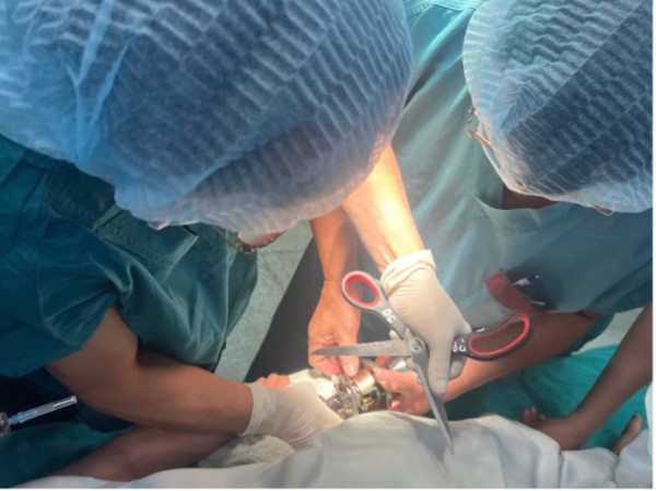 Bác sĩ 'hóa thợ khóa' cứu bé trai 5 tuổi kẹt ngón tay vào ổ khóa