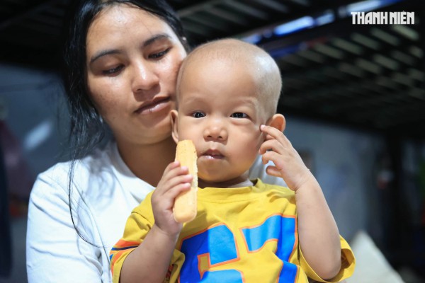 Bé trai nguy cơ mất ánh sáng vì ung thư mắt, gia đình kiệt quệ cầu cứu