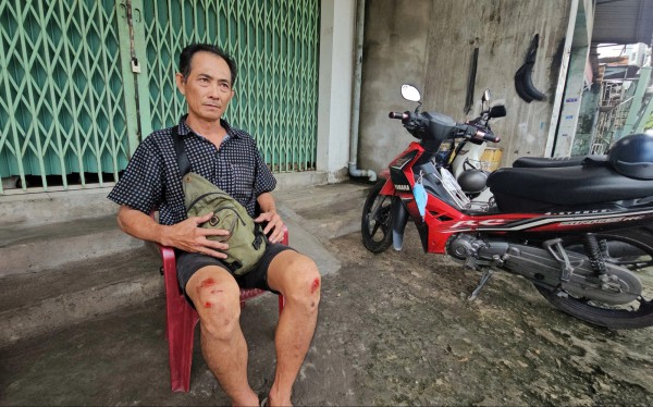 Cháy nhà cụ ông tử vong: Hàng xóm xót xa vì không cứu được nạn nhân Cháy nhà cụ ông tử vong: Hàng xóm xót xa vì không cứu được nạn nhân