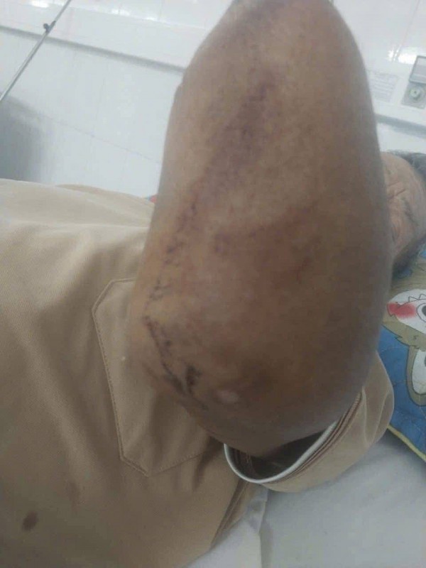 Cụ ông cụt 2 tay kẹp rắn hổ mang đem về nhà, con trai kể lại khoảnh khắc khó tin