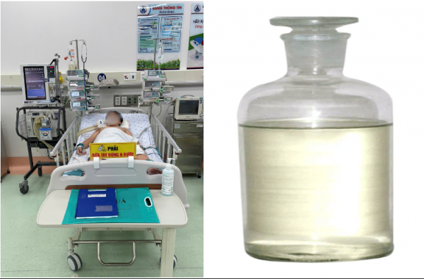 Hít phải hóa chất hàn nhựa để trong ô tô, bé trai hôn mê