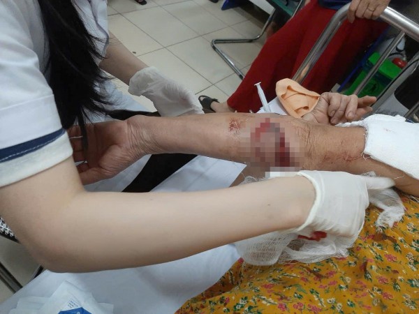 Liên tiếp các vụ chó thả rông tấn công người