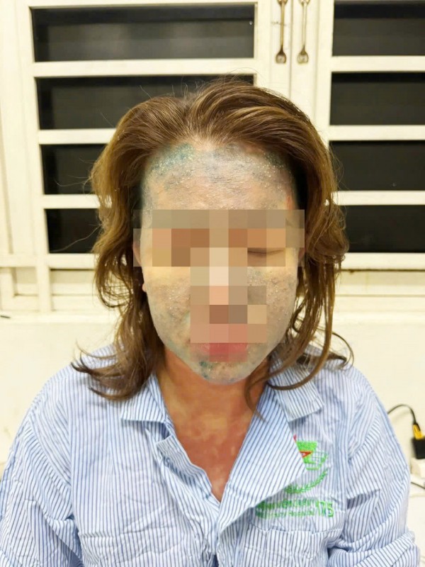 Nguy kịch vì dùng thuốc giảm cân, collagen 'xách tay' Nguy kịch vì dùng thuốc giảm cân, collagen 'xách tay'