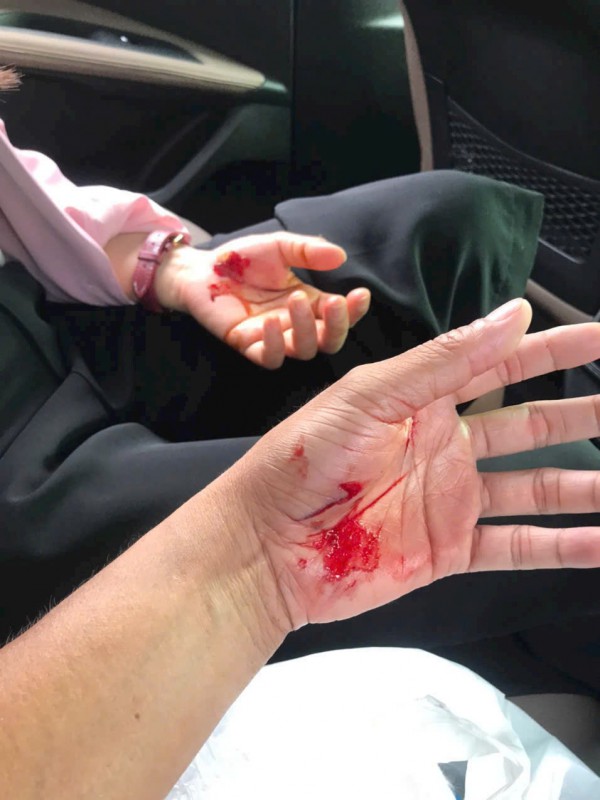 Nỗi ám ảnh mang tên chó thả rông