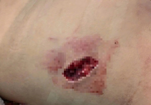 Quảng Trị: Khỉ hoang tấn công bé gái 10 tuổi nhập viện Quảng Trị: Khỉ hoang tấn công bé gái 10 tuổi nhập viện