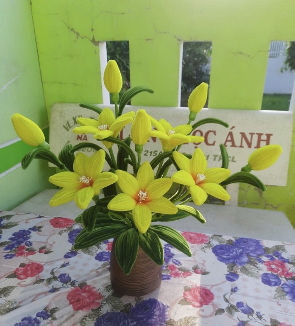 Sinh tử với bệnh hiếm - Kỳ 2: Đôi tay ‘hồi sinh’ hy vọng Sinh tử với bệnh hiếm - Kỳ 2: Đôi tay ‘hồi sinh’ hy vọng