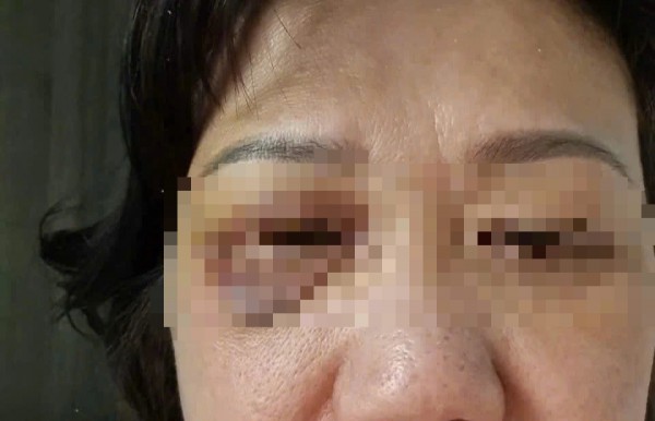 TP.HCM: 2 vợ chồng trẻ hành hung người phụ nữ 60 tuổi tại sảnh chung cư TP.HCM: 2 vợ chồng trẻ hành hung người phụ nữ 60 tuổi tại sảnh chung cư