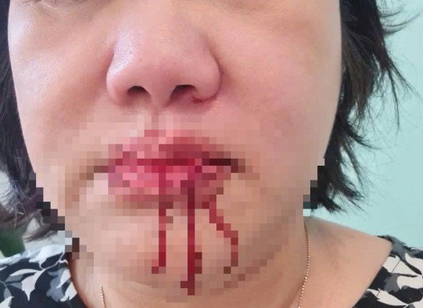 TP.HCM: 2 vợ chồng trẻ hành hung người phụ nữ 60 tuổi tại sảnh chung cư TP.HCM: 2 vợ chồng trẻ hành hung người phụ nữ 60 tuổi tại sảnh chung cư