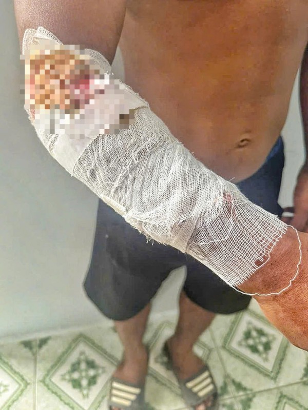 Đang câu cá, bị cá sấu tấn công Đang câu cá, bị cá sấu tấn công