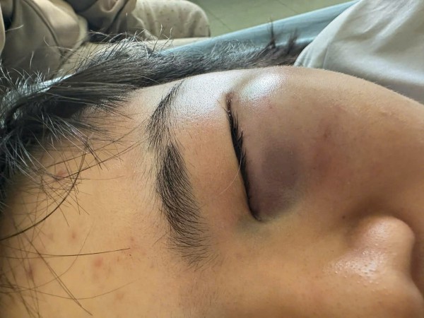 Nữ sinh lớp 7 bị nhóm nam sinh đánh hội đồng trước cổng trường: Công an vào cuộc Nữ sinh lớp 7 bị nhóm nam sinh đánh hội đồng trước cổng trường: Công an vào cuộc