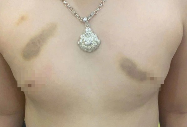 Phụ huynh tố giáo viên bạo hành trẻ, yêu cầu bồi thường 1 năm học phí Phụ huynh tố giáo viên bạo hành trẻ, yêu cầu bồi thường 1 năm học phí