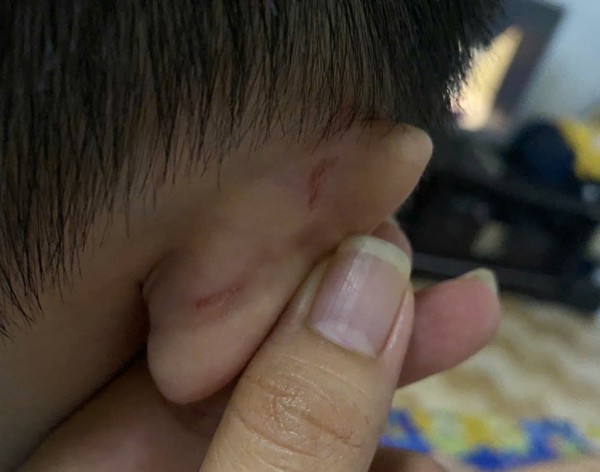 Phụ huynh tố giáo viên bạo hành trẻ, yêu cầu bồi thường 1 năm học phí Phụ huynh tố giáo viên bạo hành trẻ, yêu cầu bồi thường 1 năm học phí