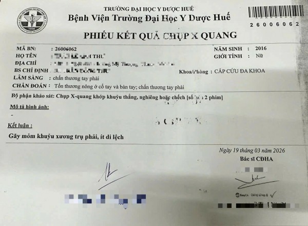 Vụ cô giáo dùng thước đánh học sinh 'chấn thương' tay: Phường công bố thông tin mới