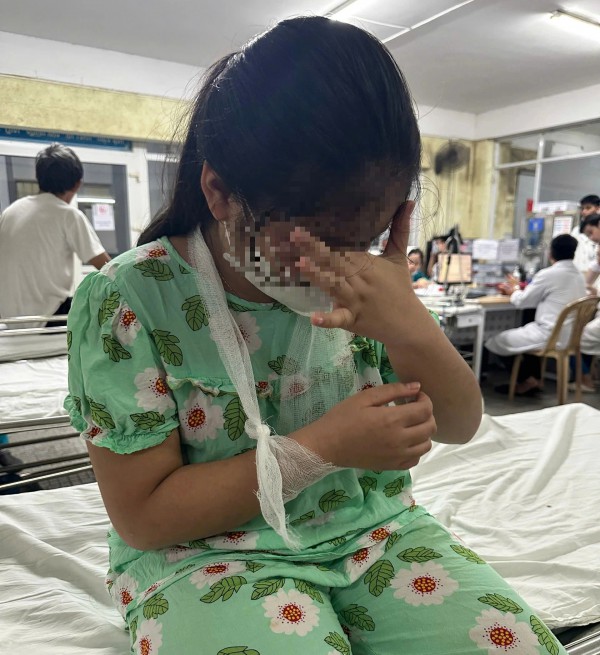 Xác minh vụ giáo viên dùng thước đánh học sinh tiểu học 'chấn thương' ở tay