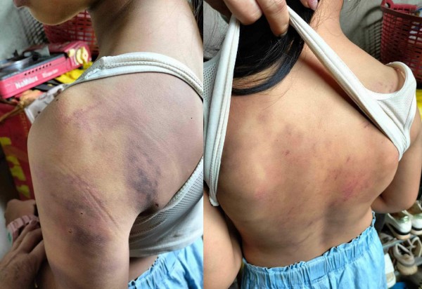 Đắk Lắk: Làm rõ vụ học sinh lớp 4 bị 10 bạn học đánh