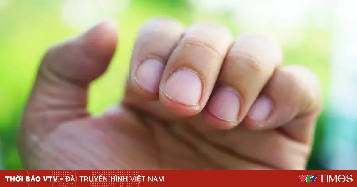 5 dấu hiệu cho thấy cơ thể cần bổ sung chất dinh dưỡng