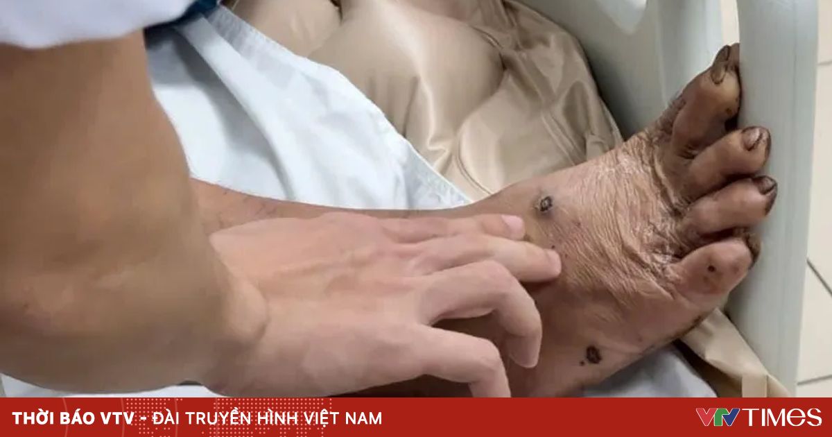 Gạch rơi vào chân khi đắp tường phòng lũ, 6 ngày phải nhập viện vì uốn ván