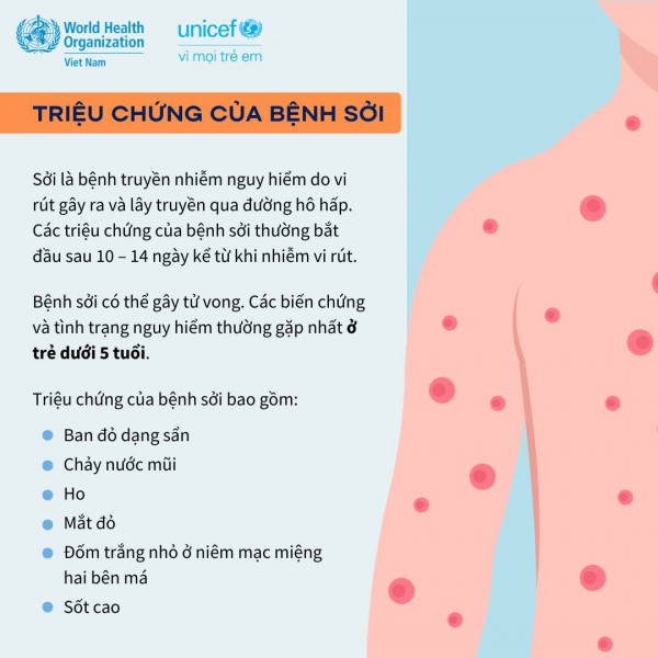 Infographic: Bệnh sởi – triệu chứng và cách phòng ngừa