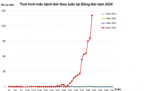 Số ca mắc bệnh sởi tại Đồng Nai tăng cao