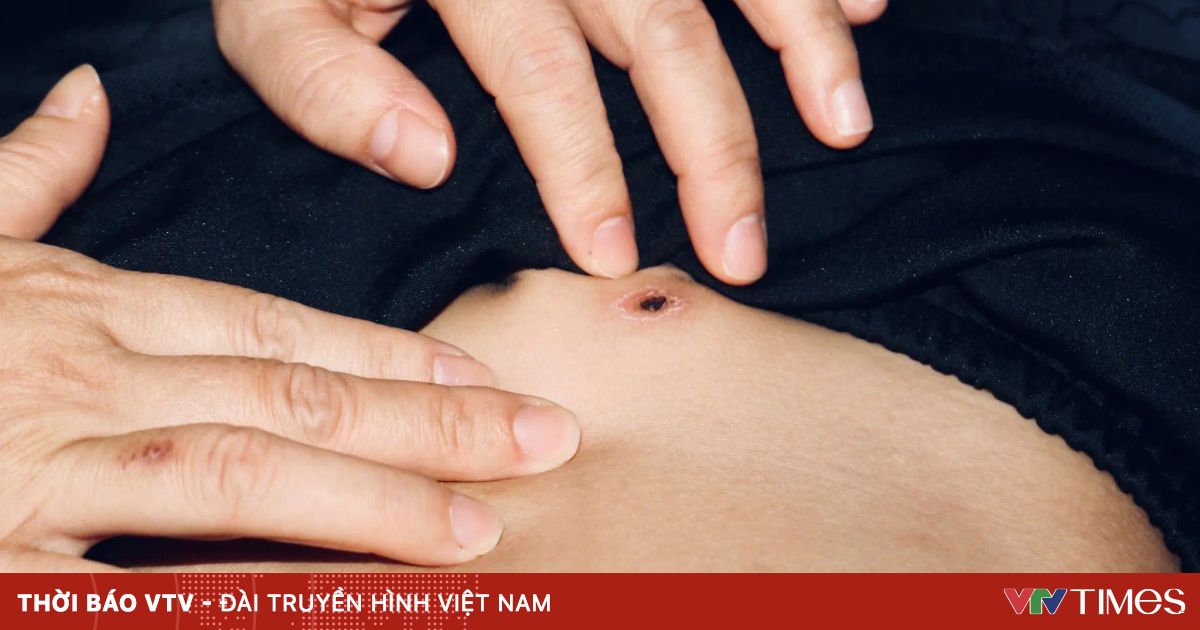 Sự nguy hiểm của sốt mò ở trẻ em