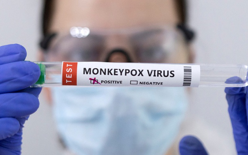 TP Hồ Chí Minh: 8 người tiếp xúc gần ca bệnh mắc đậu mùa khỉ