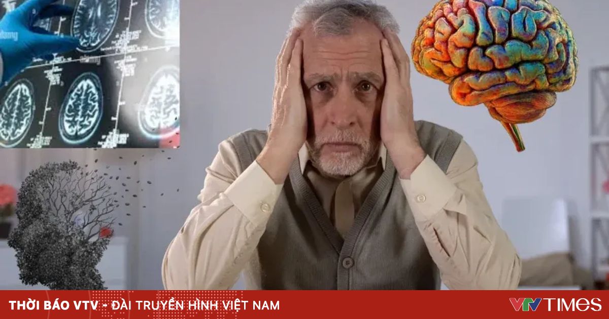 Đột phá mới trong phát hiện bệnh Alzheimer