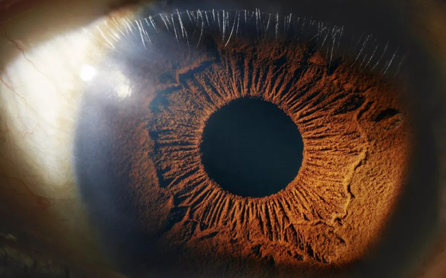 Kiểm tra mắt có thể dự đoán trước “nguy cơ tử vong sớm”