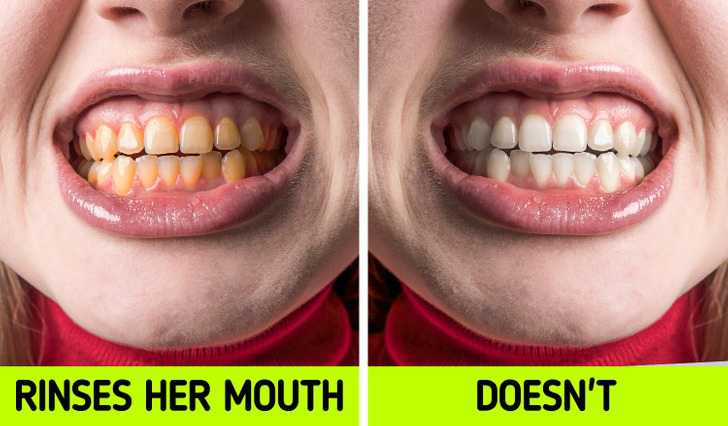 6 sai lầm khi đánh răng khiến bạn không thể có "nụ cười tỏa sáng"