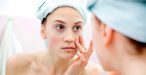 Dấu hiệu da bị dị ứng mỹ phẩm và cách xử lý