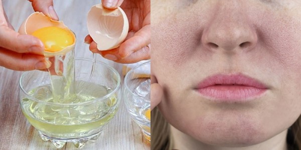 Làm đẹp từ gian bếp: Da mịn, tóc khỏe với lòng trắng trứng