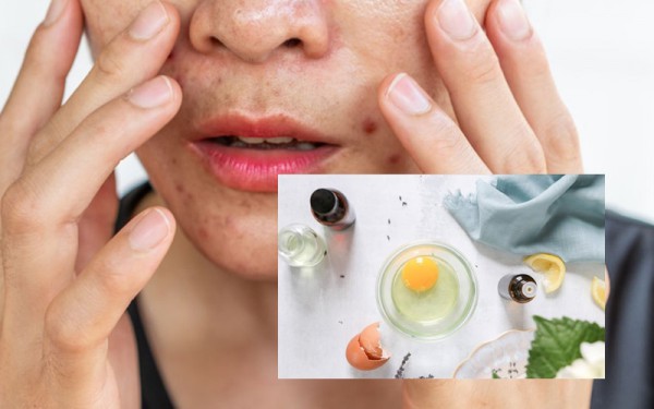 Làm đẹp từ gian bếp: Da mịn, tóc khỏe với lòng trắng trứng