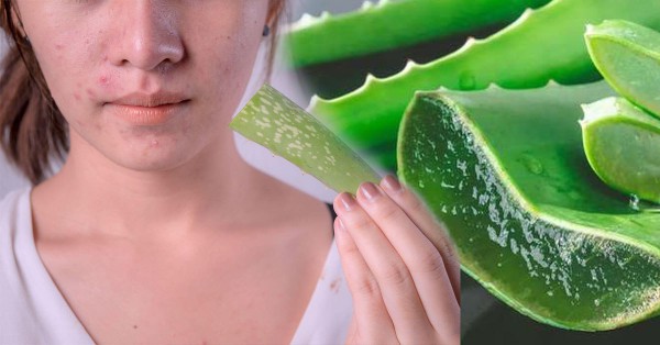 Làm đẹp từ gian bếp: Làn da ẩm mịn, căng mướt nhờ nha đam