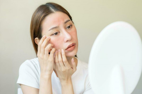 Làn da nhạy cảm hay bị nổi mẩn ngứa vào mùa hè, chăm sóc thế nào?