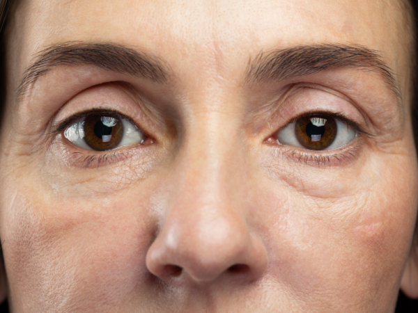 Mẹo làm giảm bọng mắt tại nhà dễ không tưởng Mẹo làm giảm bọng mắt tại nhà dễ không tưởng