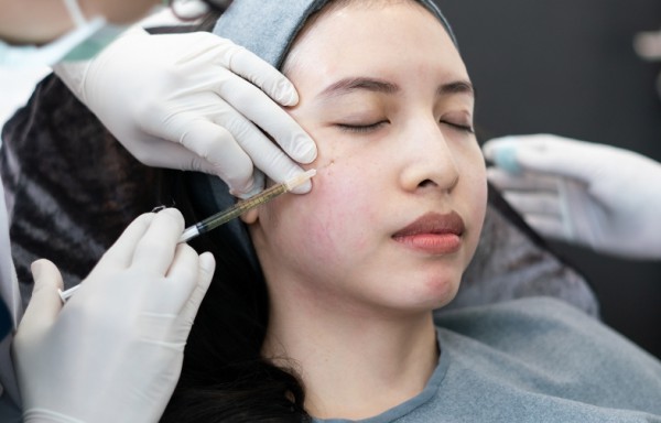 Những hệ lụy từ việc tiêm filler mà có thể bạn chưa biết
