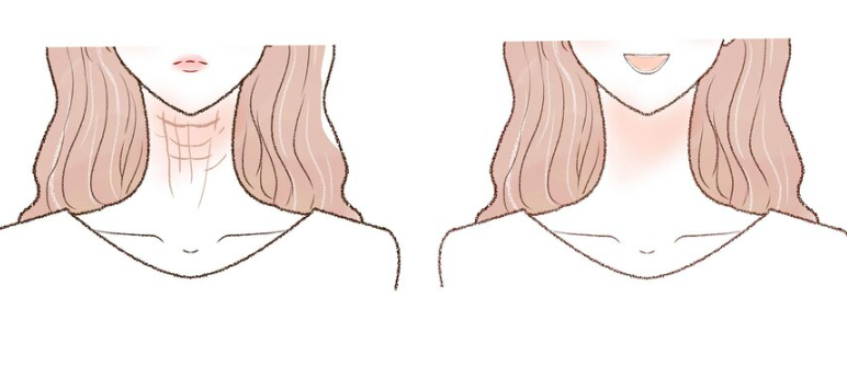 Những lý do nên dưỡng da cổ ngay từ “tuổi 20” Những lý do nên dưỡng da cổ ngay từ “tuổi 20”