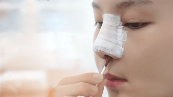 Tháo sụn mũi: Khi nào cần 