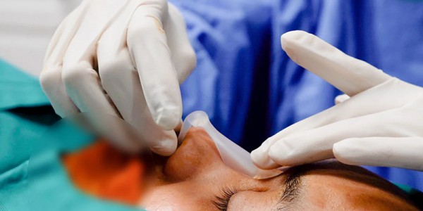 Tháo sụn mũi: Khi nào cần 