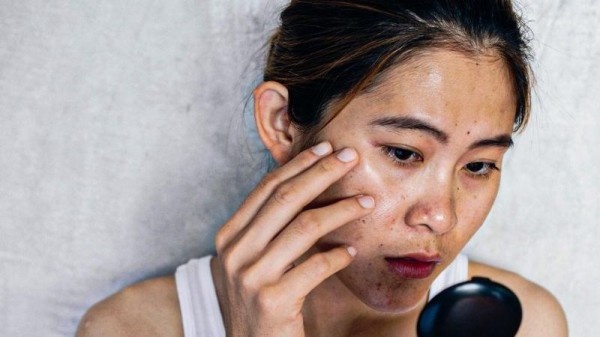 Thức uống giúp bảo dưỡng làn da sau khi đi nắng