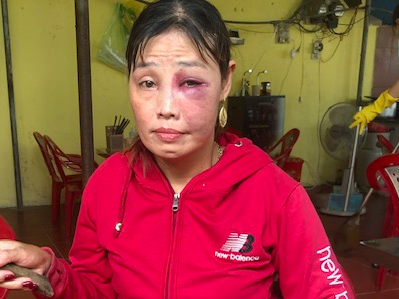 Bà Rịa – Vũng Tàu: Điều tra vụ người bán mì Quảng bị khách đánh sưng mặt