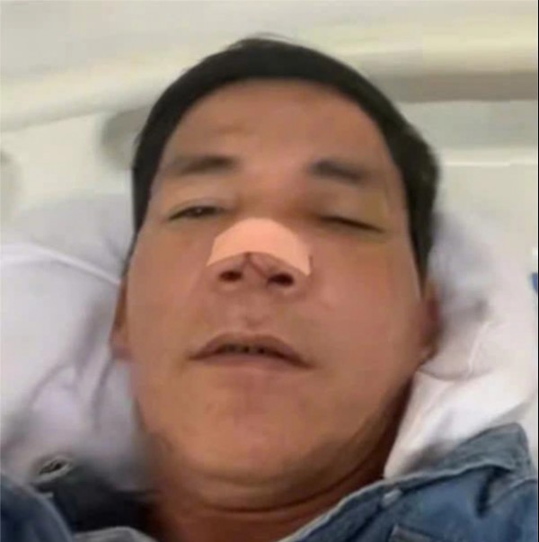 Cầu cứu vì bị nhóm người đánh gãy sống mũi ngay trước nhà