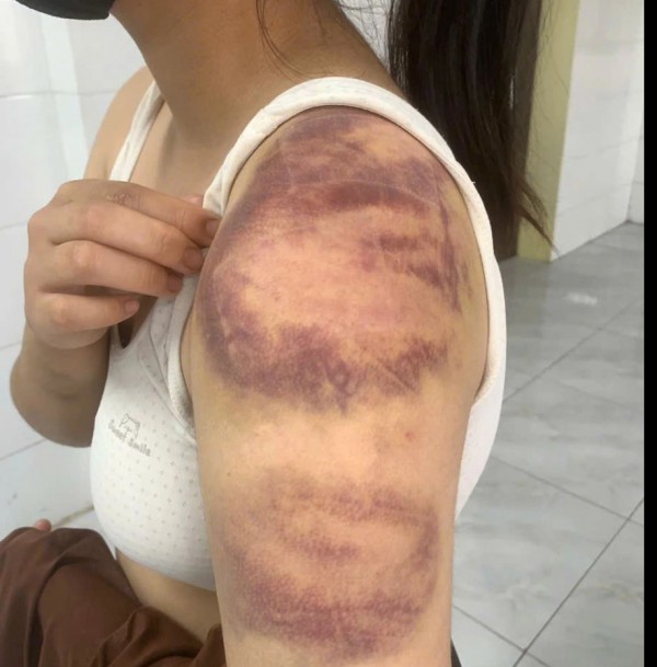 Khởi tố đối tượng trói, đánh con ruột, hành hạ vợ mang thai Khởi tố đối tượng trói, đánh con ruột, hành hạ vợ mang thai