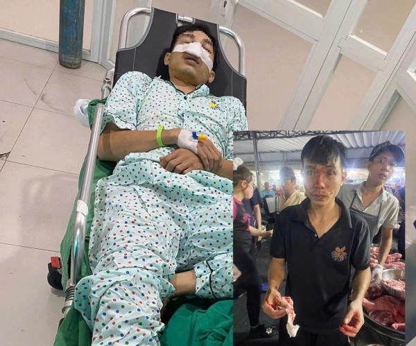 Người đàn ông bị đánh ở chợ đầu mối Hóc Môn phải nhập viện