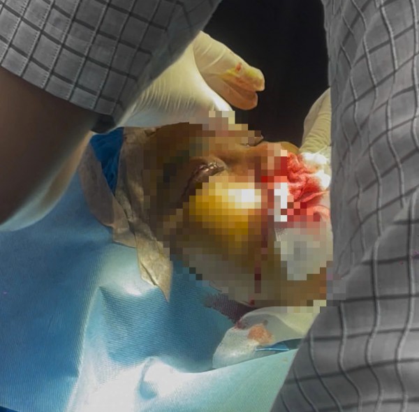 Phường Gò Vấp siết thẩm mỹ 'chui', khu CityLand là điểm 'nóng'