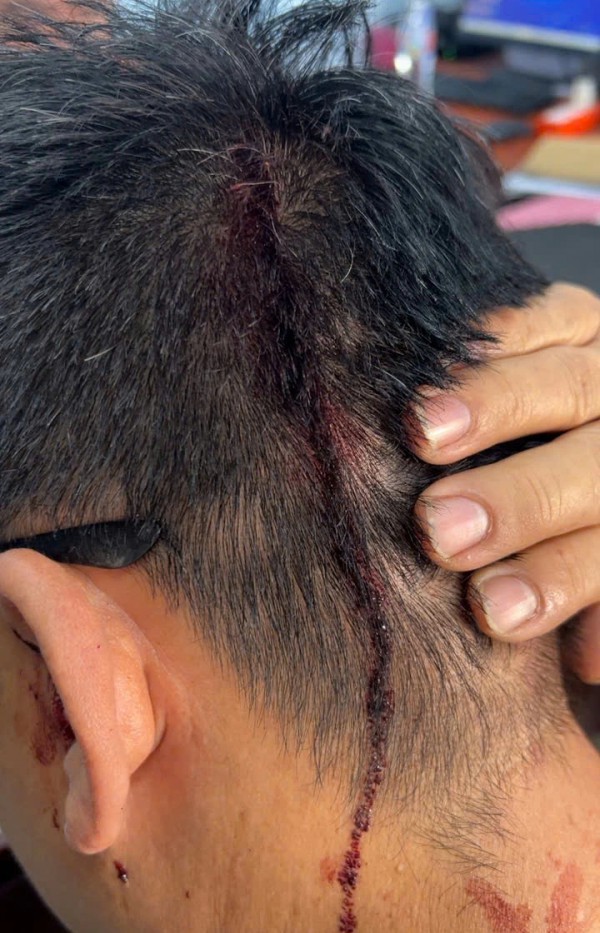 TP.HCM: Điều tra vụ người đàn ông bị hàng xóm tấn công gây thương tích