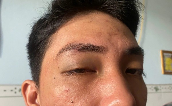 Tài xế ô tô bị hành hung vì quay phim xe tải chắn lối đi
