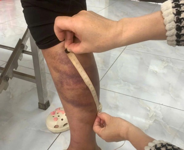 Tạm giữ hình sự đối tượng trói, đánh con ruột, hành hạ vợ mang thai Tạm giữ hình sự đối tượng trói, đánh con ruột, hành hạ vợ mang thai