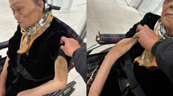 Vụ cụ bà 82 tuổi bị bạo hành: Khởi tố nữ giúp việc tội hành hạ người khác